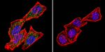 CRABP1 Antibody in Immunocytochemistry (ICC/IF)