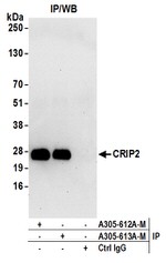 CRIP2 Antibody in Western Blot (WB)