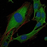 Crk Antibody in Immunocytochemistry (ICC/IF)