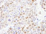 CRM1 Antibody in Immunohistochemistry (IHC)