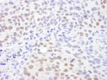 CRM1 Antibody in Immunohistochemistry (IHC)