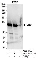 CRM1 Antibody in Western Blot (WB)