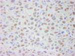 CRM1 Antibody in Immunohistochemistry (IHC)