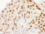 CRM1 Antibody in Immunohistochemistry (IHC)