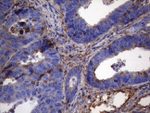 CRP Antibody in Immunohistochemistry (Paraffin) (IHC (P))