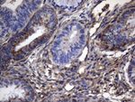 CRP Antibody in Immunohistochemistry (Paraffin) (IHC (P))