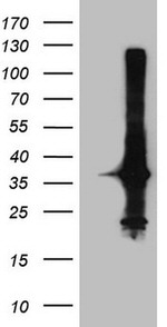 CRP Antibody in Western Blot (WB)