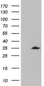 CRP Antibody in Western Blot (WB)