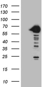 CRY1 Antibody in Western Blot (WB)