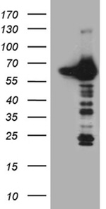 CRY1 Antibody in Western Blot (WB)