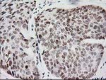 CRY2 Antibody in Immunohistochemistry (Paraffin) (IHC (P))