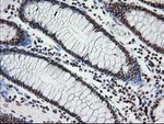 CRY2 Antibody in Immunohistochemistry (Paraffin) (IHC (P))