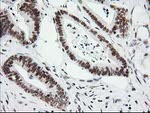 CRY2 Antibody in Immunohistochemistry (Paraffin) (IHC (P))