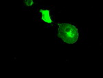 CRYAB Antibody in Immunocytochemistry (ICC/IF)