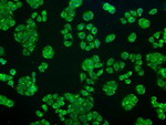 CRYAB Antibody in Immunocytochemistry (ICC/IF)