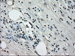 CRYAB Antibody in Immunohistochemistry (Paraffin) (IHC (P))