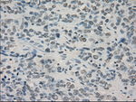 CRYAB Antibody in Immunohistochemistry (Paraffin) (IHC (P))