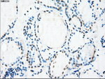 CRYAB Antibody in Immunohistochemistry (Paraffin) (IHC (P))