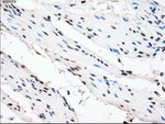 CRYAB Antibody in Immunohistochemistry (Paraffin) (IHC (P))