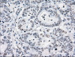 CRYAB Antibody in Immunohistochemistry (Paraffin) (IHC (P))