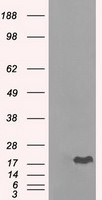 CRYAB Antibody in Western Blot (WB)