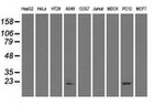 CRYAB Antibody in Western Blot (WB)