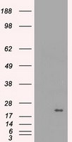 CRYAB Antibody in Western Blot (WB)