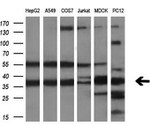 CRYM Antibody in Western Blot (WB)