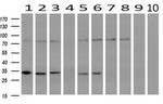 CRYM Antibody in Western Blot (WB)