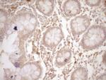 CSF1 Antibody in Immunohistochemistry (Paraffin) (IHC (P))