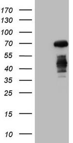 CSF1 Antibody in Western Blot (WB)