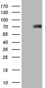 CSF1 Antibody in Western Blot (WB)