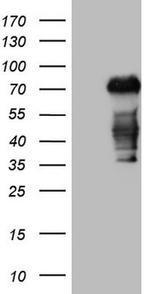 CSF1 Antibody in Western Blot (WB)