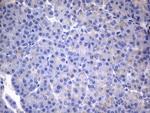 CSF2 Antibody in Immunohistochemistry (Paraffin) (IHC (P))