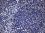 CSF2 Antibody in Immunohistochemistry (Paraffin) (IHC (P))