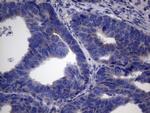 CSF2 Antibody in Immunohistochemistry (Paraffin) (IHC (P))