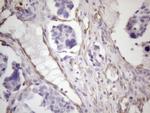 CSF2 Antibody in Immunohistochemistry (Paraffin) (IHC (P))