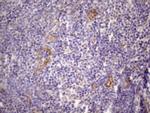 CSF2 Antibody in Immunohistochemistry (Paraffin) (IHC (P))