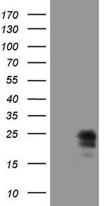 CSF2 Antibody in Western Blot (WB)