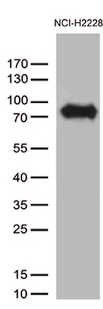 CSF2RA Antibody in Western Blot (WB)