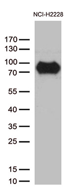 CSF2RA Antibody in Western Blot (WB)