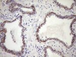 CSF2RB Antibody in Immunohistochemistry (Paraffin) (IHC (P))