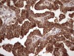 CSF2RB Antibody in Immunohistochemistry (Paraffin) (IHC (P))