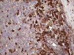 CSF2RB Antibody in Immunohistochemistry (Paraffin) (IHC (P))