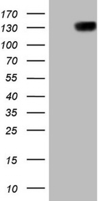 CSF2RB Antibody in Western Blot (WB)