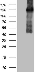 CSF2RB Antibody in Western Blot (WB)