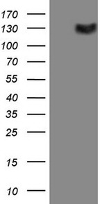 CSF2RB Antibody in Western Blot (WB)