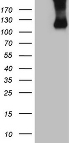 CSF2RB Antibody in Western Blot (WB)