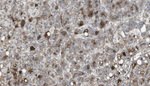 Vitronectin Antibody in Immunohistochemistry (Paraffin) (IHC (P))