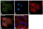 Vitronectin Antibody in Immunocytochemistry (ICC/IF)